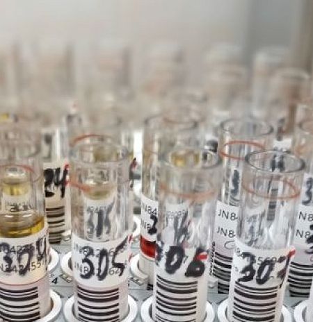 Почему сдавал анализы в Пушкинской больнице, а приходит результат с пометкой Королёва?