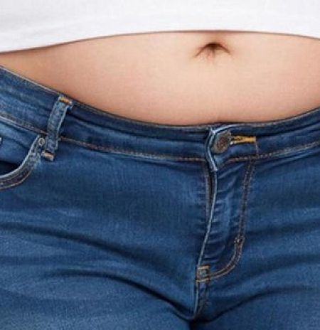 Абдоминопластика = эстетика?